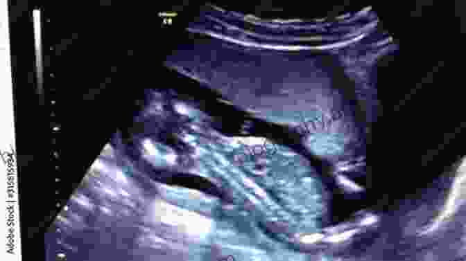 A Sonogram Image Of A Developing Fetus, Showcasing The Remarkable Details Of Its Tiny Limbs And Organs. Physiology In Childbearing: With Anatomy And Related Biosciences