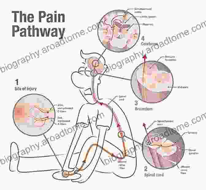 An Illustration Of Pain Receptors In The Body Understanding Pain: Exploring The Perception Of Pain