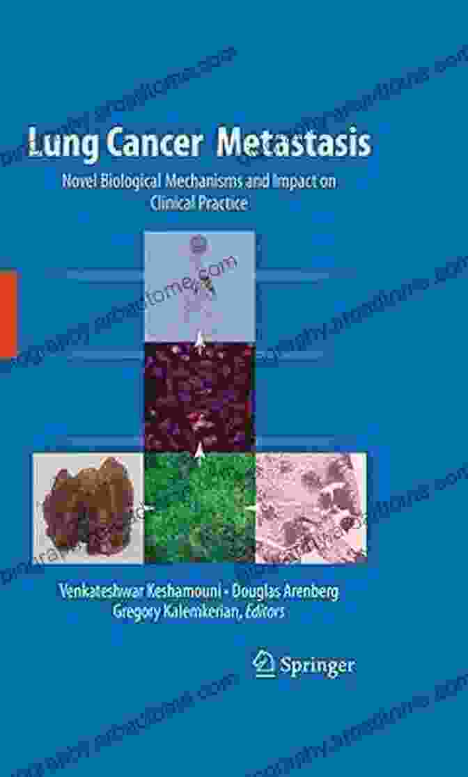 Book Cover Of Novel Biological Mechanisms And Impact On Clinical Practice Lung Cancer Metastasis: Novel Biological Mechanisms And Impact On Clinical Practice