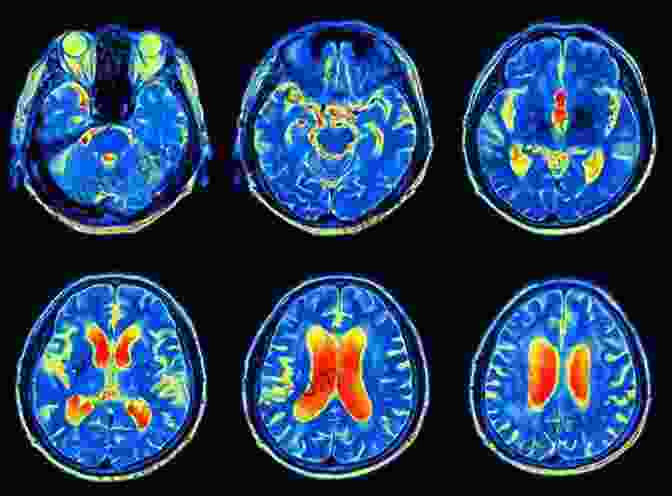 Brain Scans Illustrate Neural Activity Related To Religious Experiences Contradictions: Neuroscience And Religion (Springer Praxis Books)