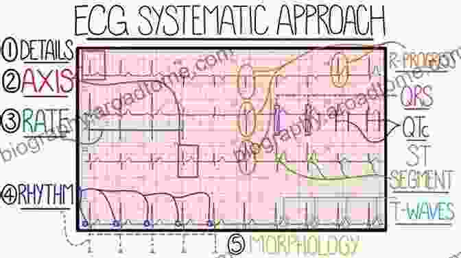 ECG Interpretation Made Easy Interpreting ECGs: A Practical Approach