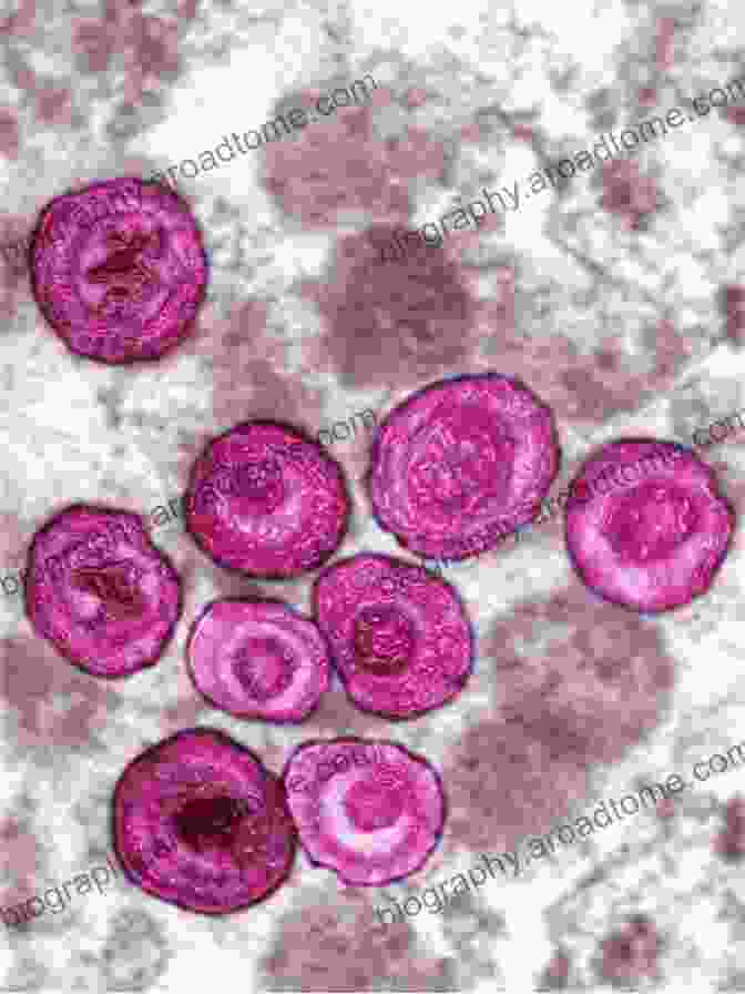 Electron Microscopy Image Of Human Cytomegalovirus Human Cytomegalovirus (Current Topics In Microbiology And Immunology 325)