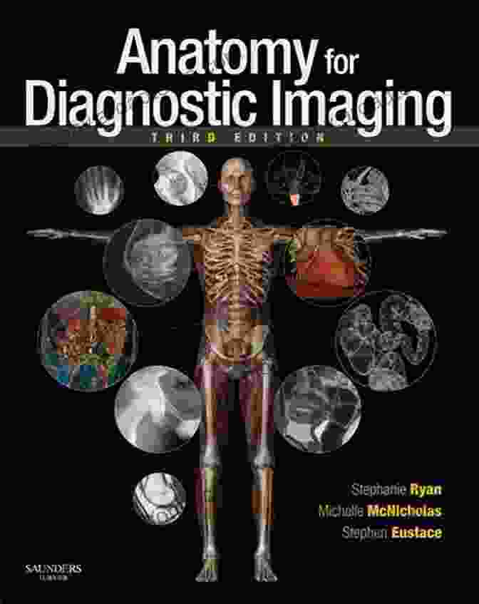 Imaging In Transplantation Medical Radiology Book Cover Featuring A Vibrant Illustration Of A Heart Transplant Imaging In Transplantation (Medical Radiology)