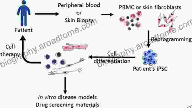 Induced Pluripotent Stem Cells (iPSCs) Being Generated From A Patient's Skin Cells Stem Cell Biology In Health And Disease