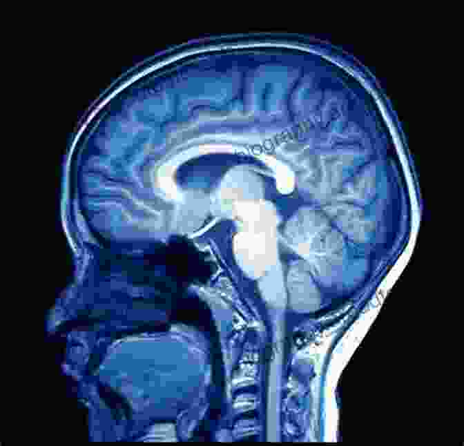 Magnetic Resonance Imaging (MRI) Of The Brain In Dementia Neuroimaging In Dementia