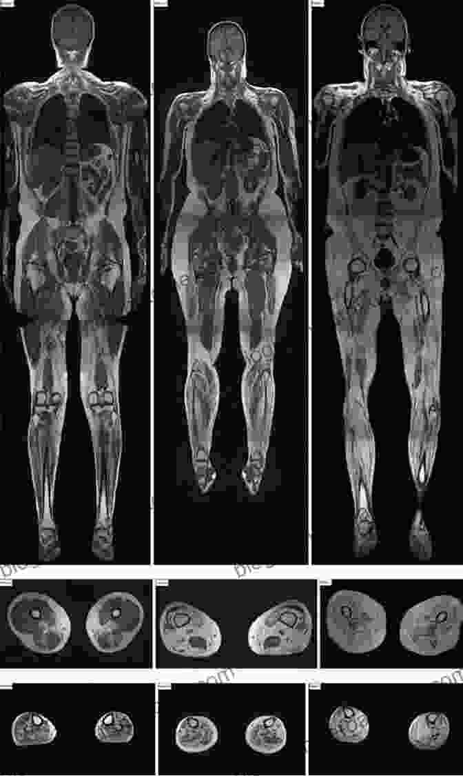 MRI Scan Showing Different Body Parts Review Questions For MRI