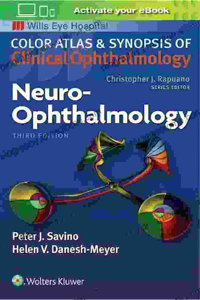 Neuro Ophthalmology Illustrated Book Cover Neuro Ophthalmology Illustrated