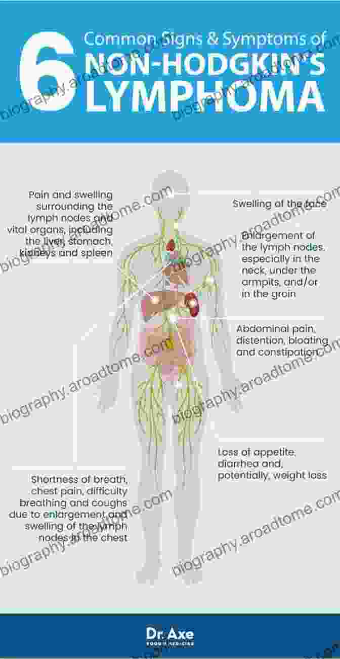 Swollen Lymph Nodes In Non Hodgkin Lymphoma Cancers In People With HIV And AIDS: Progress And Challenges