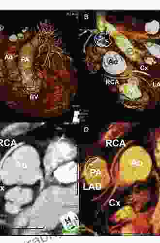 Cardiac CT And MR For Adult Congenital Heart Disease