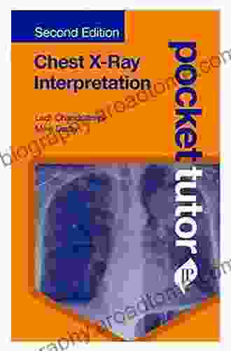 Pocket Tutor: Chest X Ray Interpretation