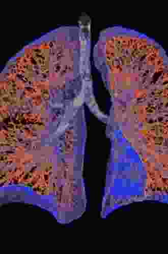 MRI Of The Lung (Medical Radiology)