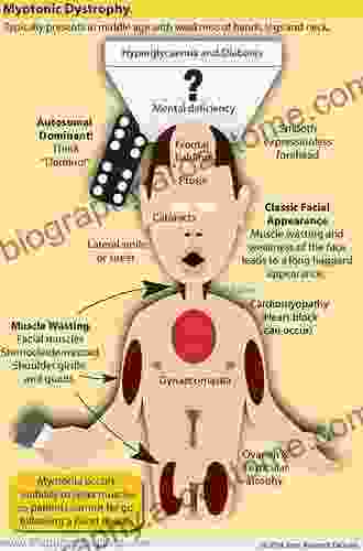 Myotonic Dystrophy (The Facts)