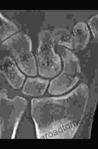 Imaging of the Hand and Wrist: Techniques and Applications (Medical Radiology)