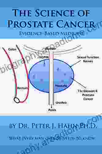 The Science Of Prostate Cancer