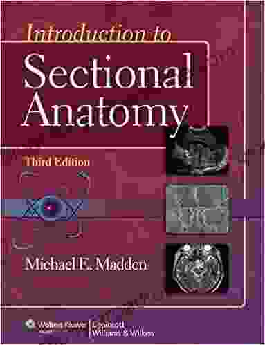 Introduction To Sectional Anatomy (Point (Lippincott Williams Wilkins))