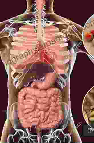 Bacterial Infections Of Humans: Epidemiology And Control